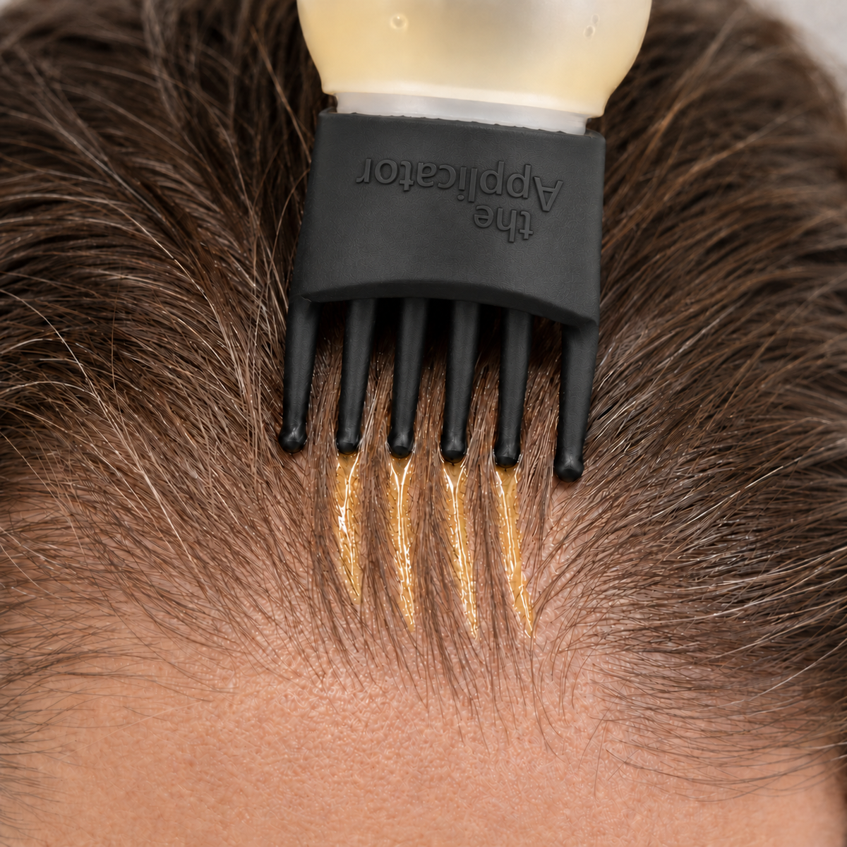 The Applicator – Präzisions-Kopfhaut-Applikator